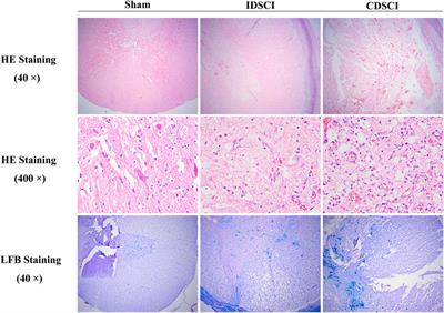 Elucidating the Potential Mechanisms Underlying Distraction Spinal Cord Injury-Associated Neuroinflammation and Apoptosis